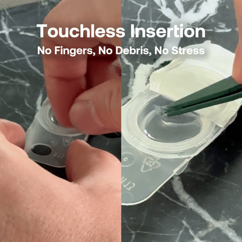 Animation of a soft contact lens being gently transferred onto the Optodex Y-Tip applicator for finger free contact lens insertion.